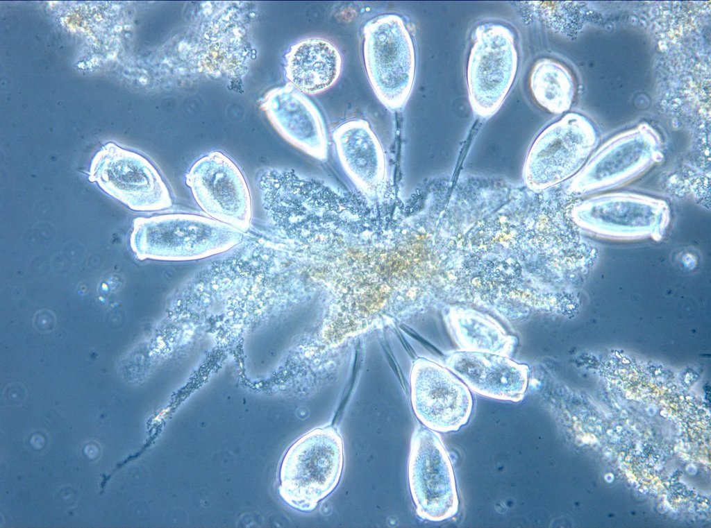 Mikroskop-Aufnahme von Glockentierchen im Wiener Abwasser. © ebswien