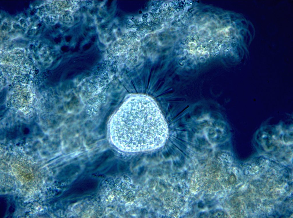 Mikroskop-Aufnahme von Tokophrya im Wiener Abwasser. © ebswien