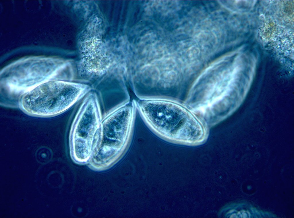 Mikroskop-Aufnahme von festsitzenden Wimperntierchen im Wiener Abwasser. © ebswien